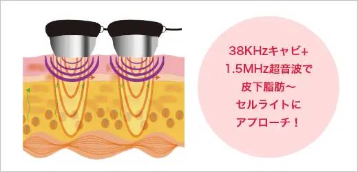 キャビテーション+超音波