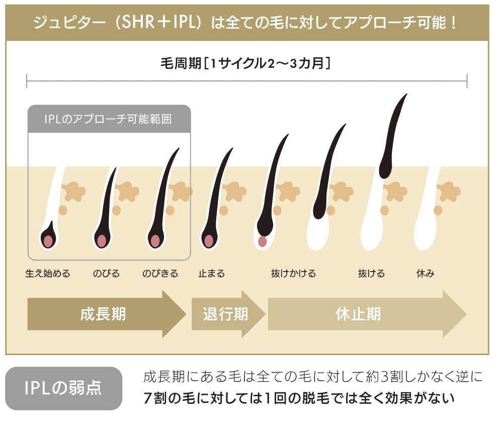 「SHR＋IPL除毛システム」